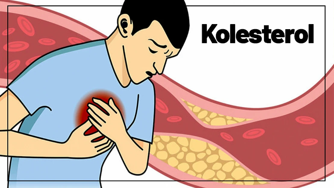 Kolesterol nasıl dengelenir?