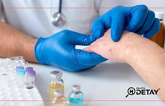 Vücuttaki kaşıntı nasıl geçer?