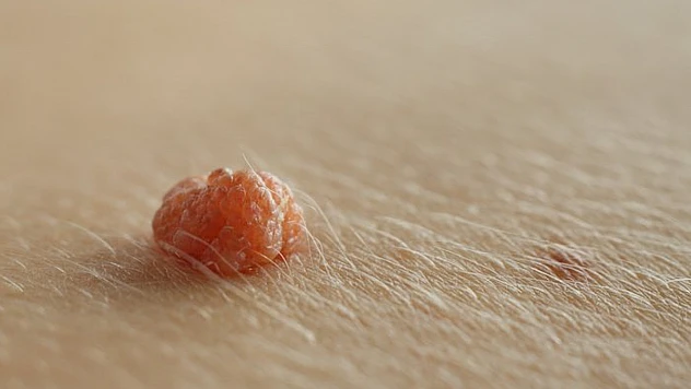 Uzmanlardan Uyarı: Et Benlerini Evde Koparmayın!